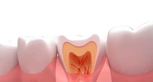拔牙后频繁吞口水会影响出血量吗(拔牙后频繁吞咽口水会有什么后果)
