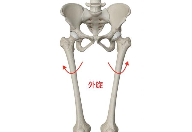 而o型腿则相反,因股骨发生了外旋,导致两腿间膝盖距离增大